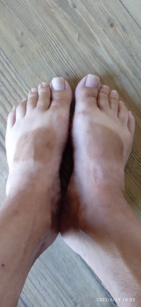 Summer Feet.jpg